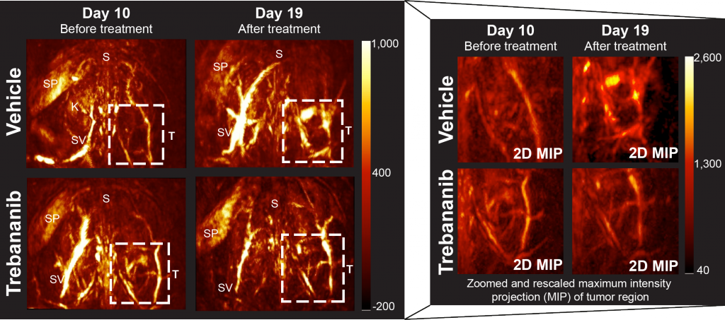 Figure 3 - Photoacoustic Images